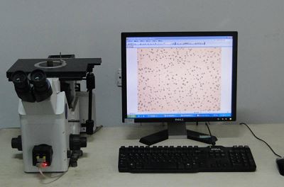 Spheroidizing analyzer